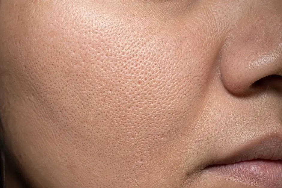Close-up of visible pores on the cheek beside the nose